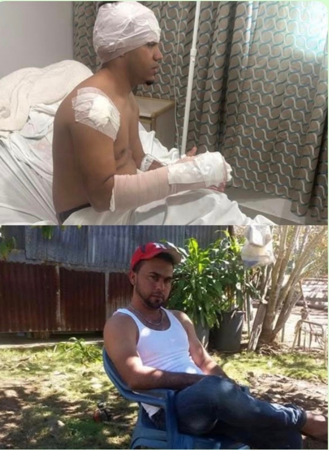 Aplazan medida de coerción contra acusado de herir a joven en Santiago Rodríguez; autoridades investigan hallazgo de tres cadáveres